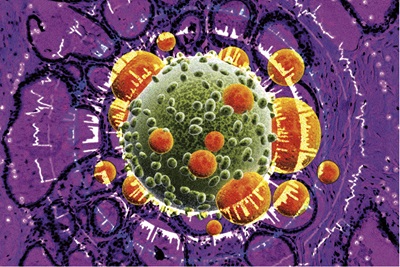 A colorful illustration of a cancer cell